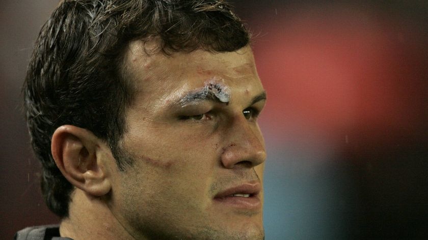 Bismarck du Plessis' red card struck from the record after IRB admit to ...