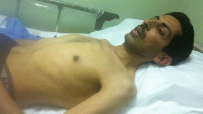 Jailed Shiite activist Abdulhadi al-Khawaja lies in a hospital bed in Bahrain, 2012