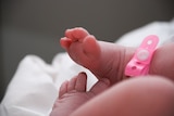 A baby girl's feet with an identification bracelet.