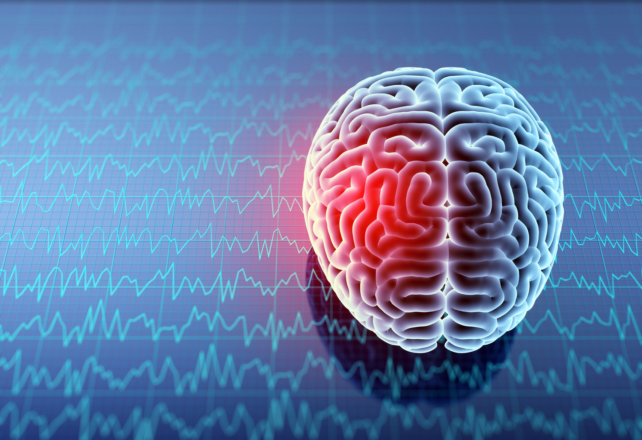 More knowledge and preventive care is needed in concussion and chronic ...