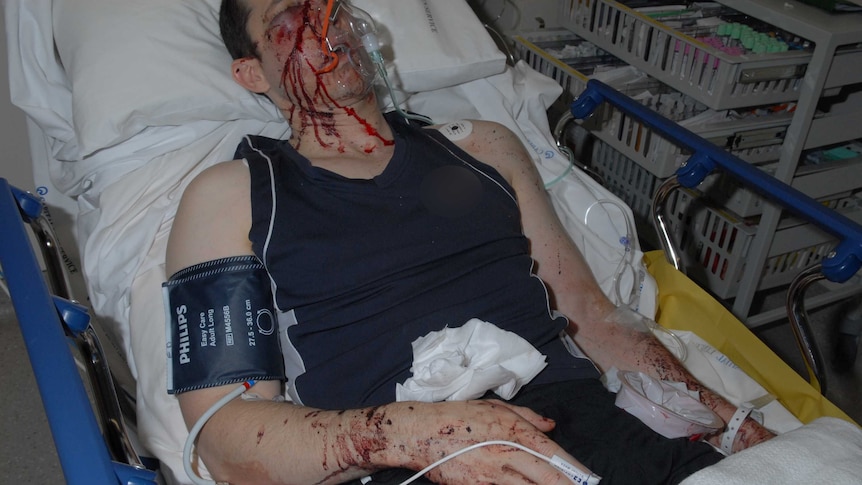 A man's face is blurred. He lies bloodied in a hospital bed.
