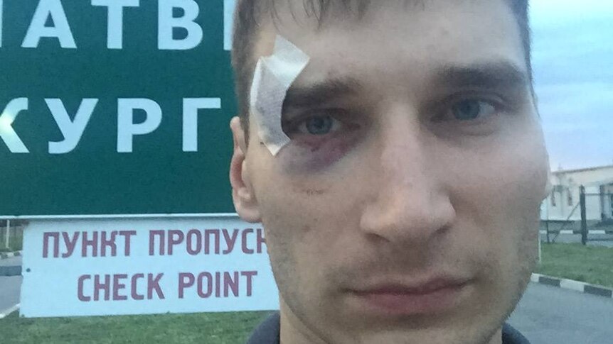 Pavel Kanygin selfie after being beaten up