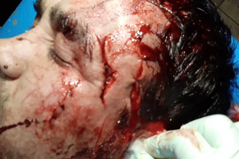 large cuts covered in blood are seen on the side of a man's head.