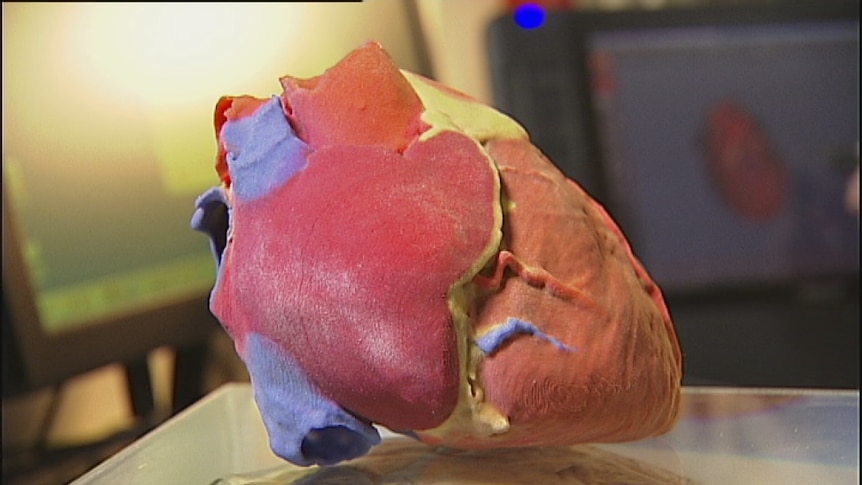 3D-printed heart