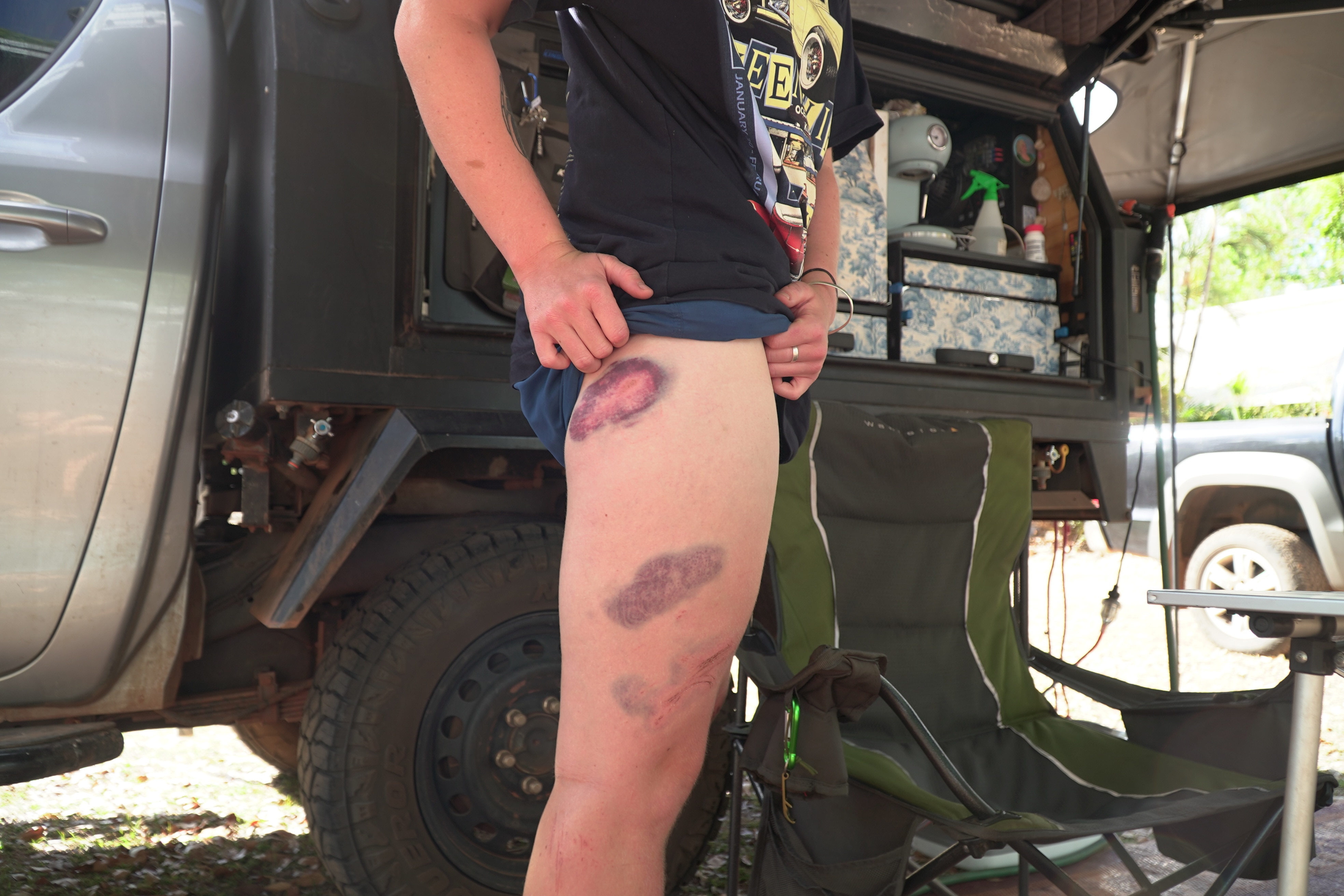 Tourist left bruised after being charged twice by wild buffalo