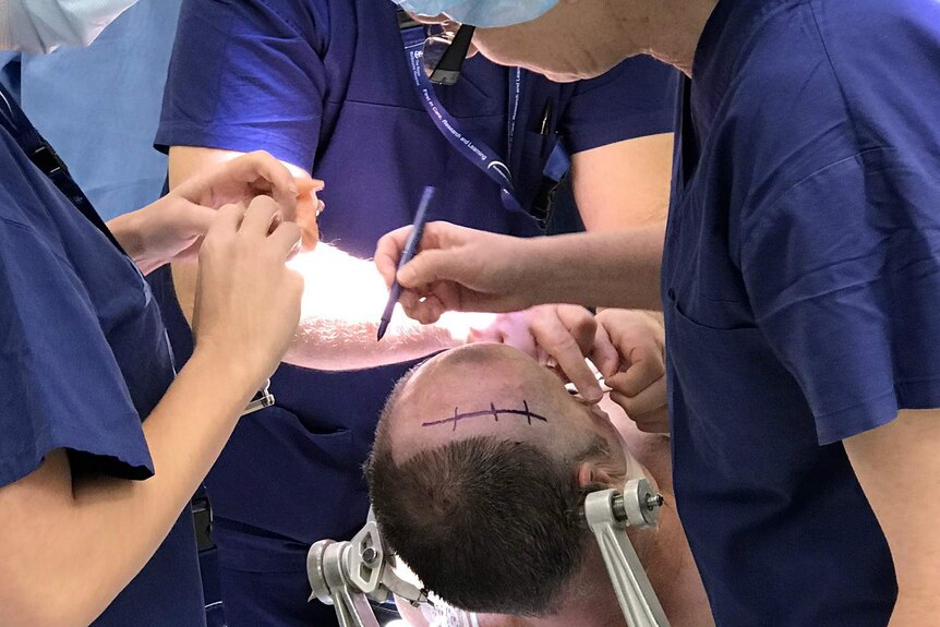 Surgeons draw a line on a man's shaved head to indicate where they will operate.