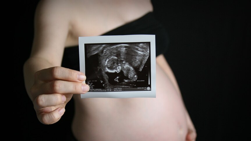 A pregnant woman holding a sonogram