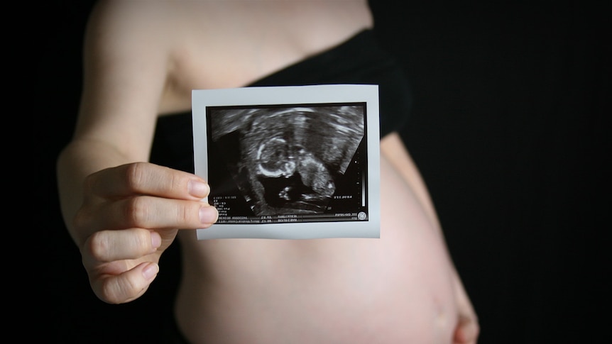 A pregnant woman holding an ultrasound photo