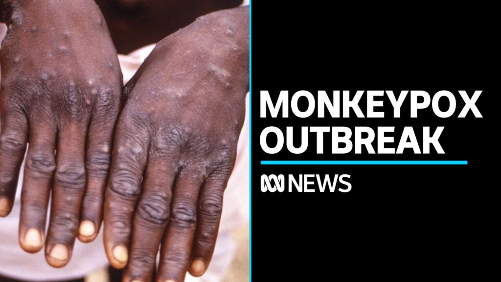 Play Video. Duration: 2 minutes 20 seconds