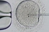 A microscopic image of human sperm being implanted into an egg.
