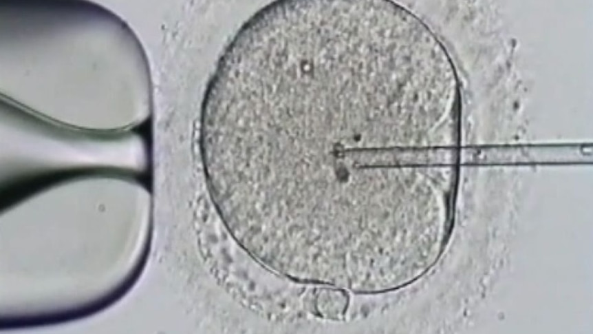 A microscopic image of human sperm being implanted into an egg.