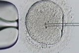 IVF treatment