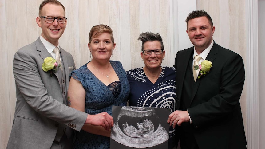 4 people hold a scan of a baby, two men wear suits and two women wear blue dresses