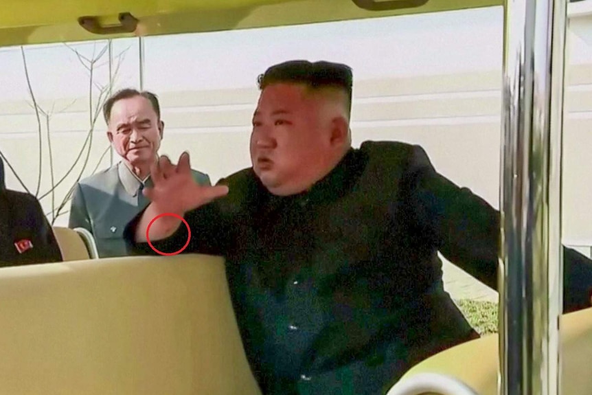 Kim Jong-un in a golf cart with a small scar on his wrist