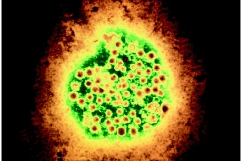 A coloured image of a virus.