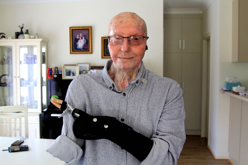 Terry Lee suffered burns to 75 per cent of his body, losing both of his hands and an eye, as a result of the Pinery bushfire.