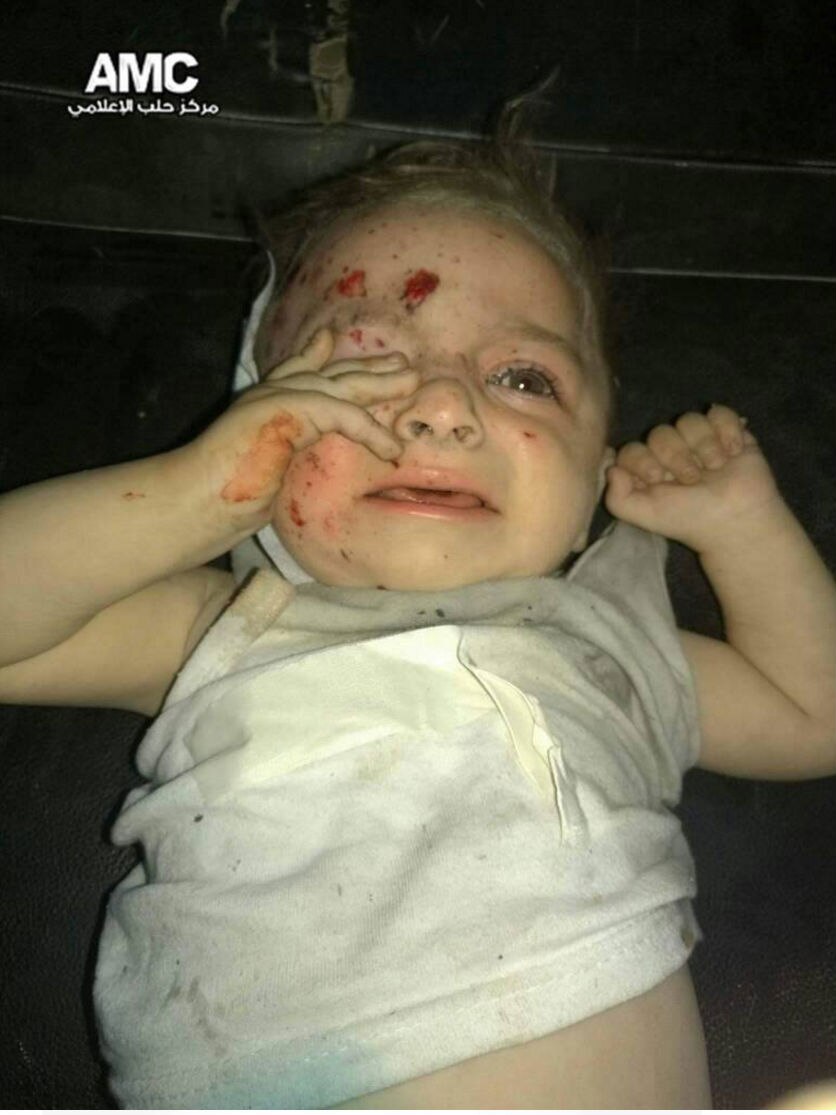 A crying child with blood on their head rubs their eye.