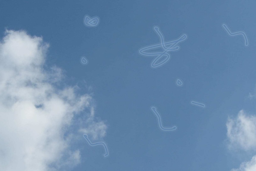 A blue sky with white squiggly "floaters".
