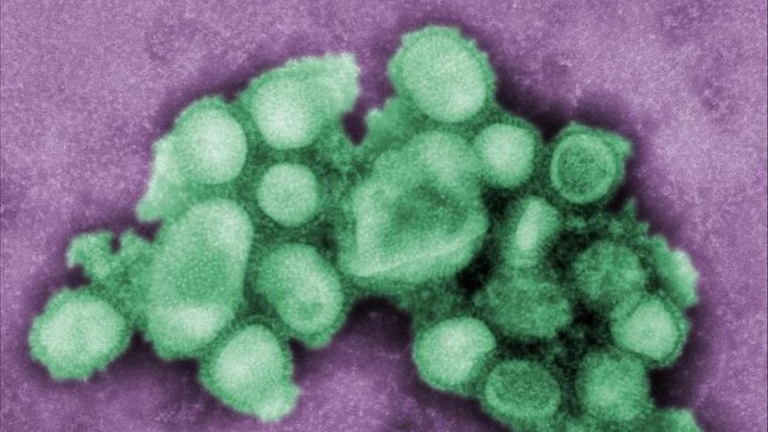 On the rise: there are now about 70 confirmed cases swine flu in Australia.