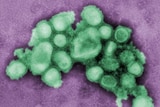 Artificially-coloured image of swine flu virus