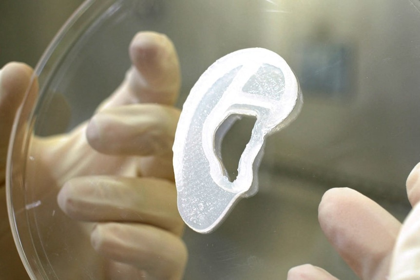 3D printed ear 3D Bio Therapeutics