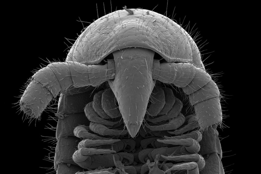 The head under a microscope.