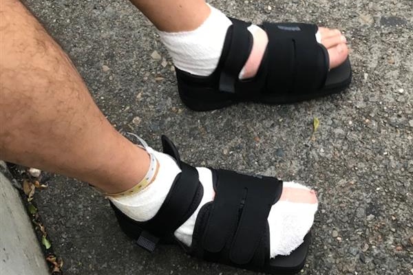 Two bandaged feet in black sandels