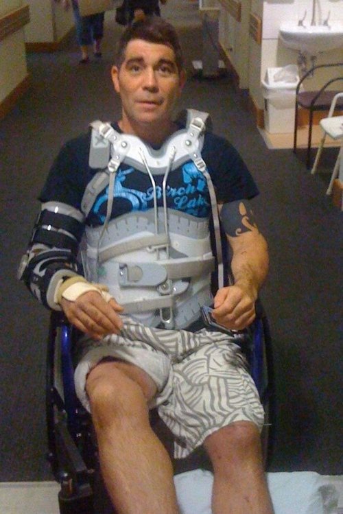 a man sitting in a wheel chair with a full body brace and casts on his arm and legs