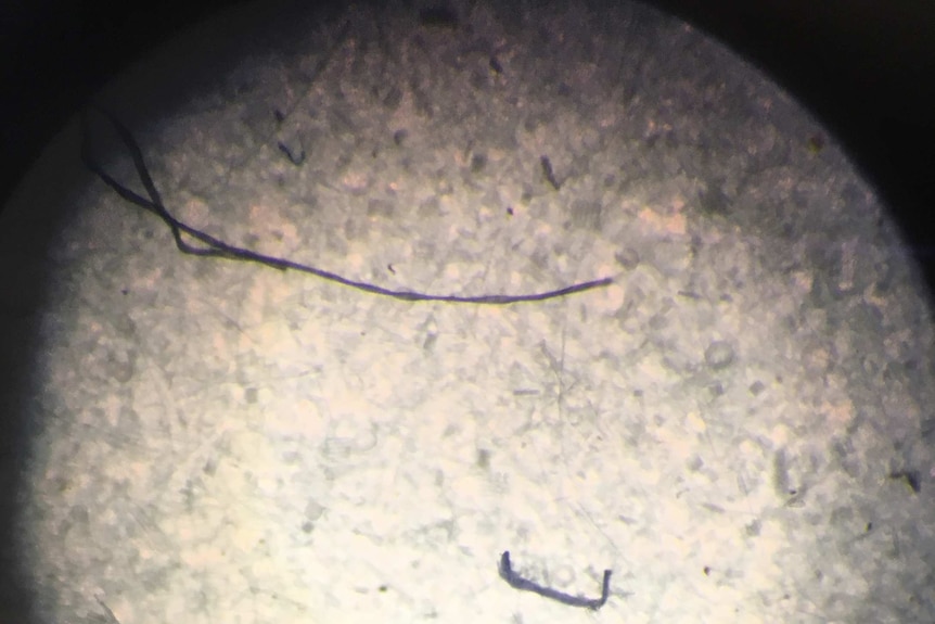 Microplastics under a microscope.