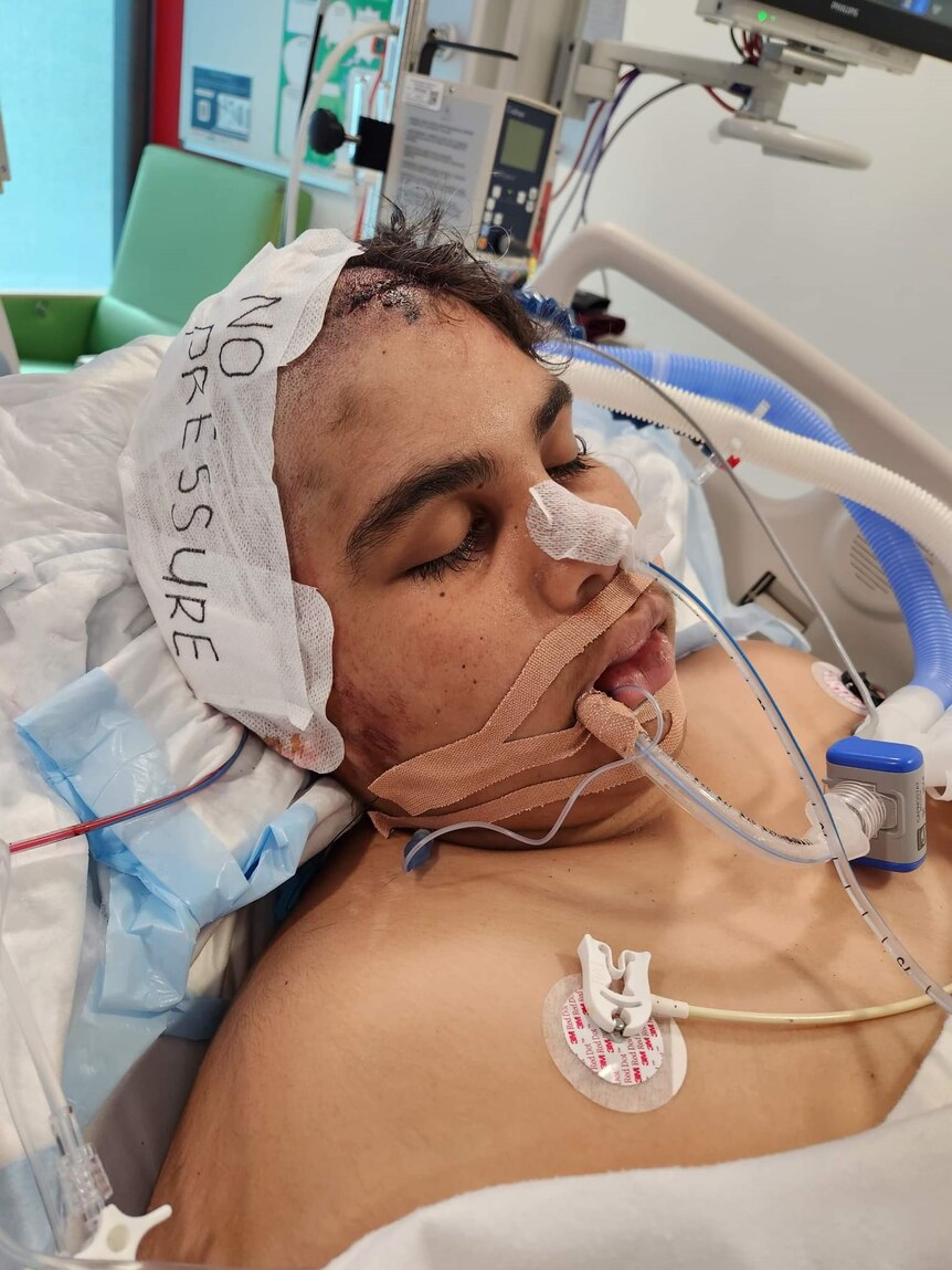 Cassius lies in hospital in a critical condition 