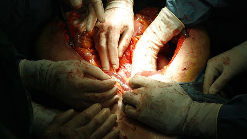 Doctors' hands extract organs from a patient's stomach
