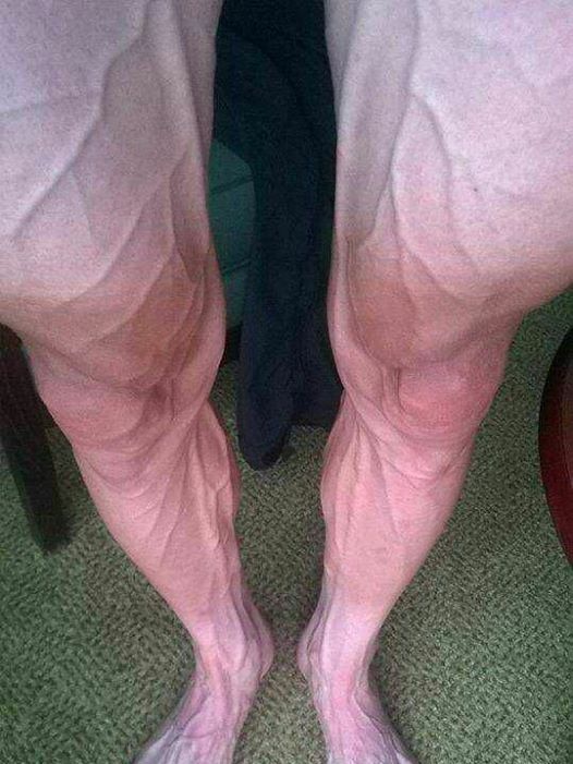 Bartosz Huzarski's legs on Facebook