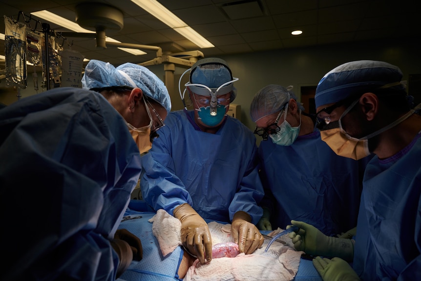 Surgeons standing around an operating table.  One is holding a kidney