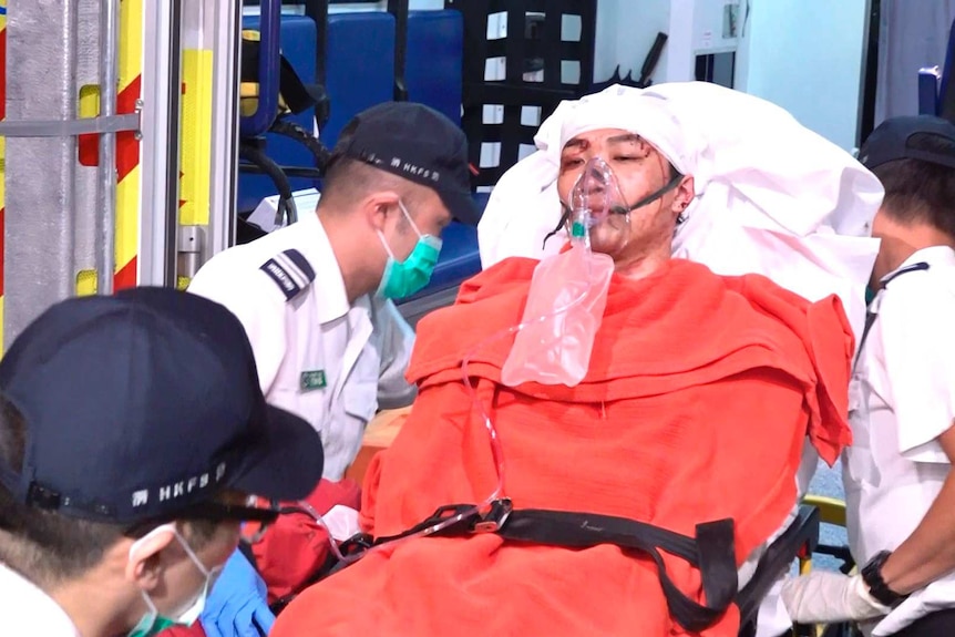 Civil Human Rights Front convenor Jimmy Sham, in a stretcher with a bloodied face, is carried to hospital in Hong Kong.