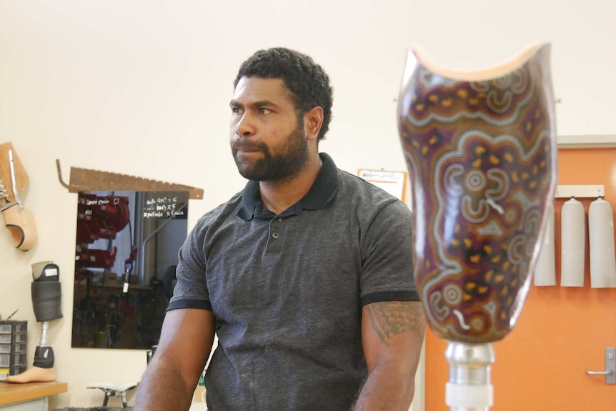 Inosi Bulimairewa sits behind a painted prosthetic leg. The leg is covered with Aboriginal designs.