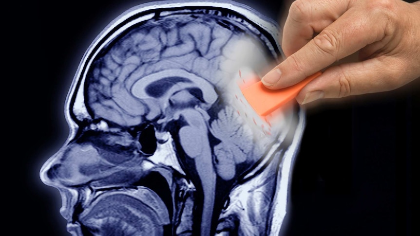 X-ray of a human skull and brain being partly erased