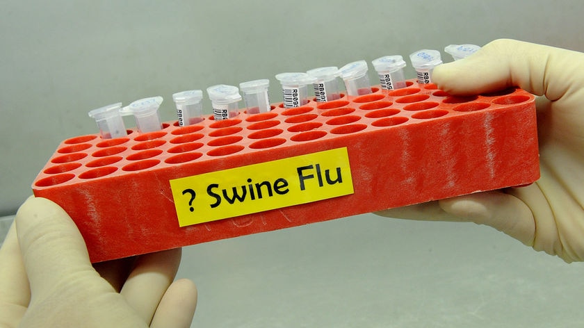 Swine flu influenza test vials