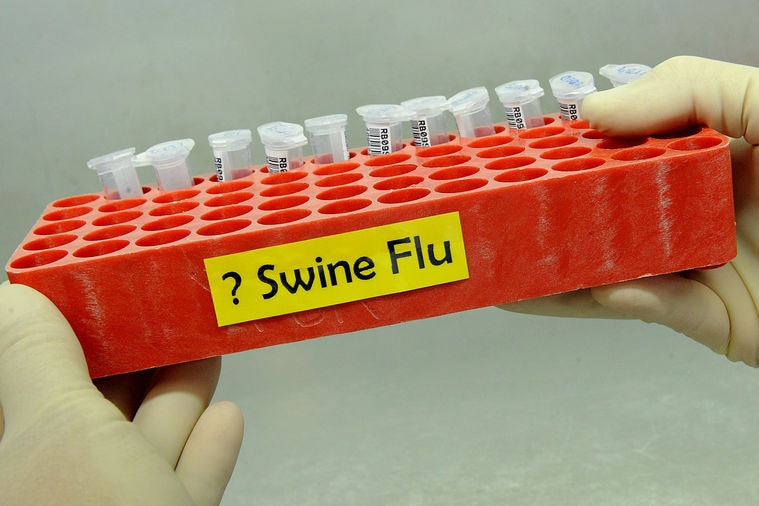 Swine flu influenza test vials
