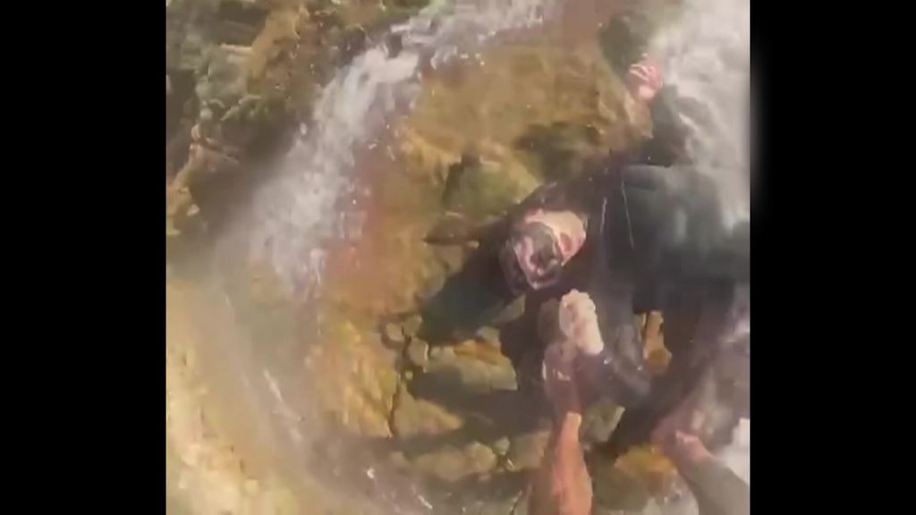 Shark bite victims records the incident