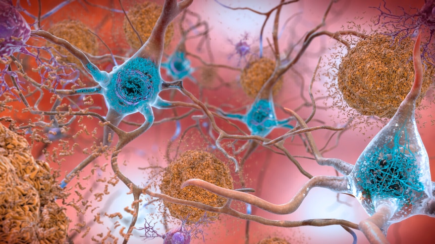 An illustration of neurons in a brain. 