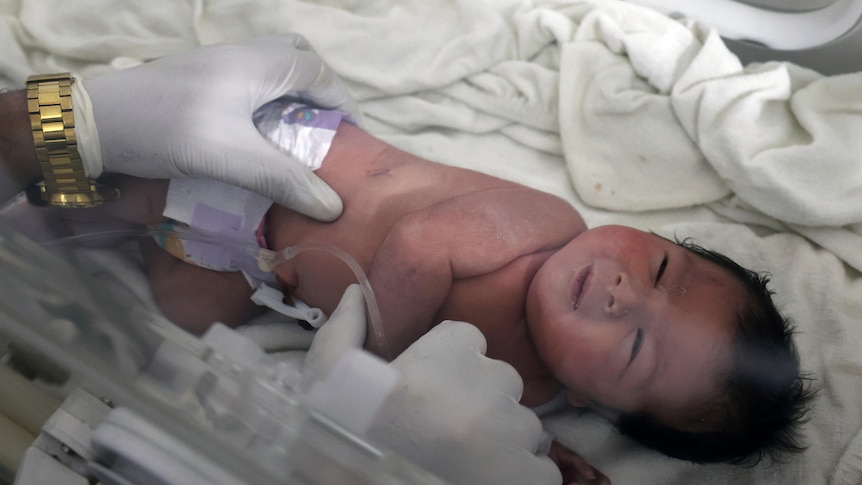 A baby girl who was born under the rubble lies in an incubator.