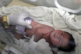 A baby girl who was born under the rubble lies in an incubator.