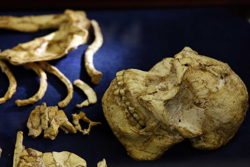 A skull and bones are seen in a display case.