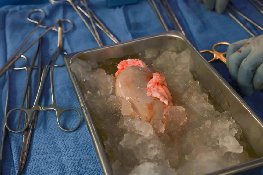 A pig kidney sits on ice, awaiting transplantation into a living huma
