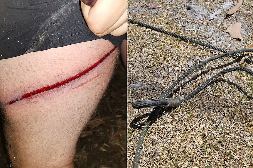 A composite image of a man with a red wound on his leg and a thick cable lying on the grass.