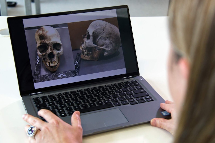 A woman looks at a laptop that is displaying pictures of a human skull.