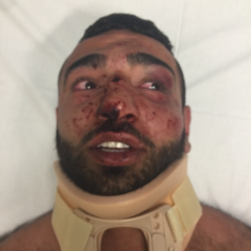 Alleged victim of Green Valley bashing, Omar El Baba