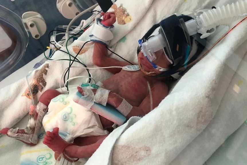 Premature baby Rafferty Robb in a crib hooked up to tubes in NICU at Mater Mothers' Hospital in Brisbane