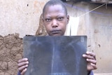 Pamela Aoko, frowning and standing in front of a brown wall, holding an X-ray in front of her showing a bullet in her chest
