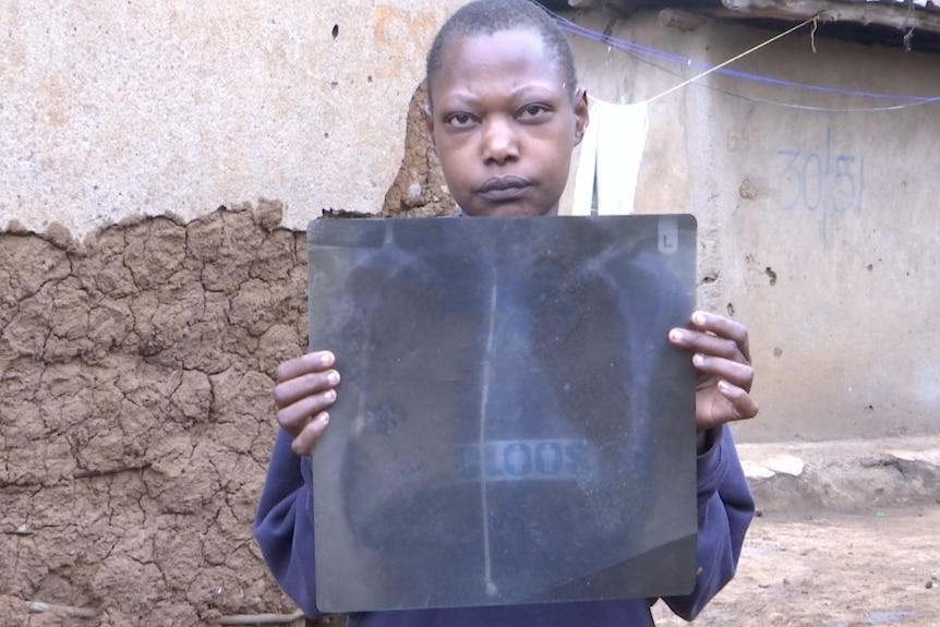 Pamela Aoko, frowning and standing in front of a brown wall, holding an X-ray in front of her showing a bullet in her chest